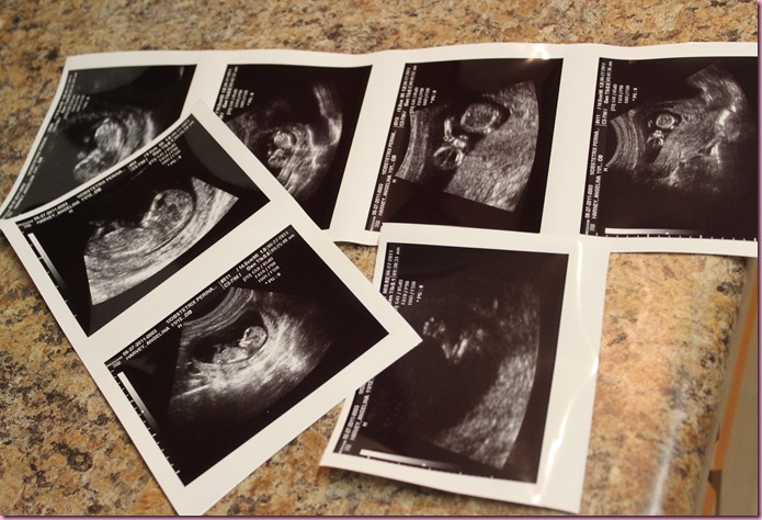 ultrasound pictures