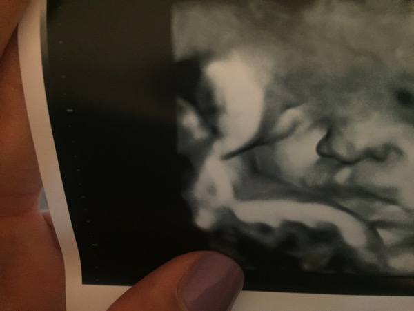 Baby ultrasound 36 weeks
