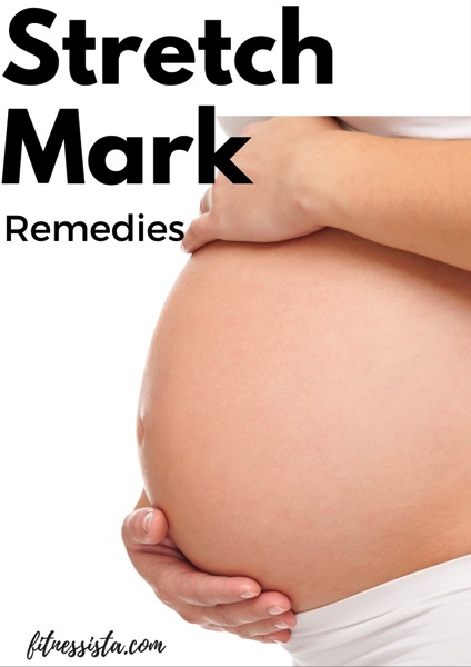 Stretch mark remedies