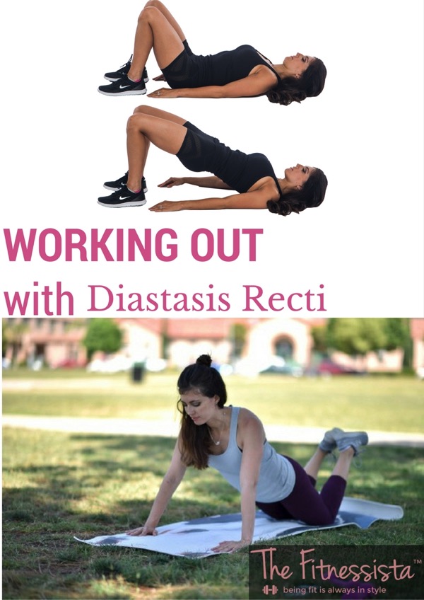 15 Safe Diastasis Recti Postpartum Ab Exercises That Work! - Diary