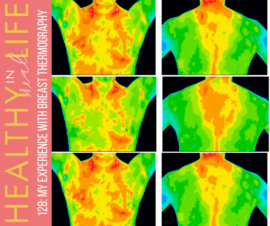 thermography